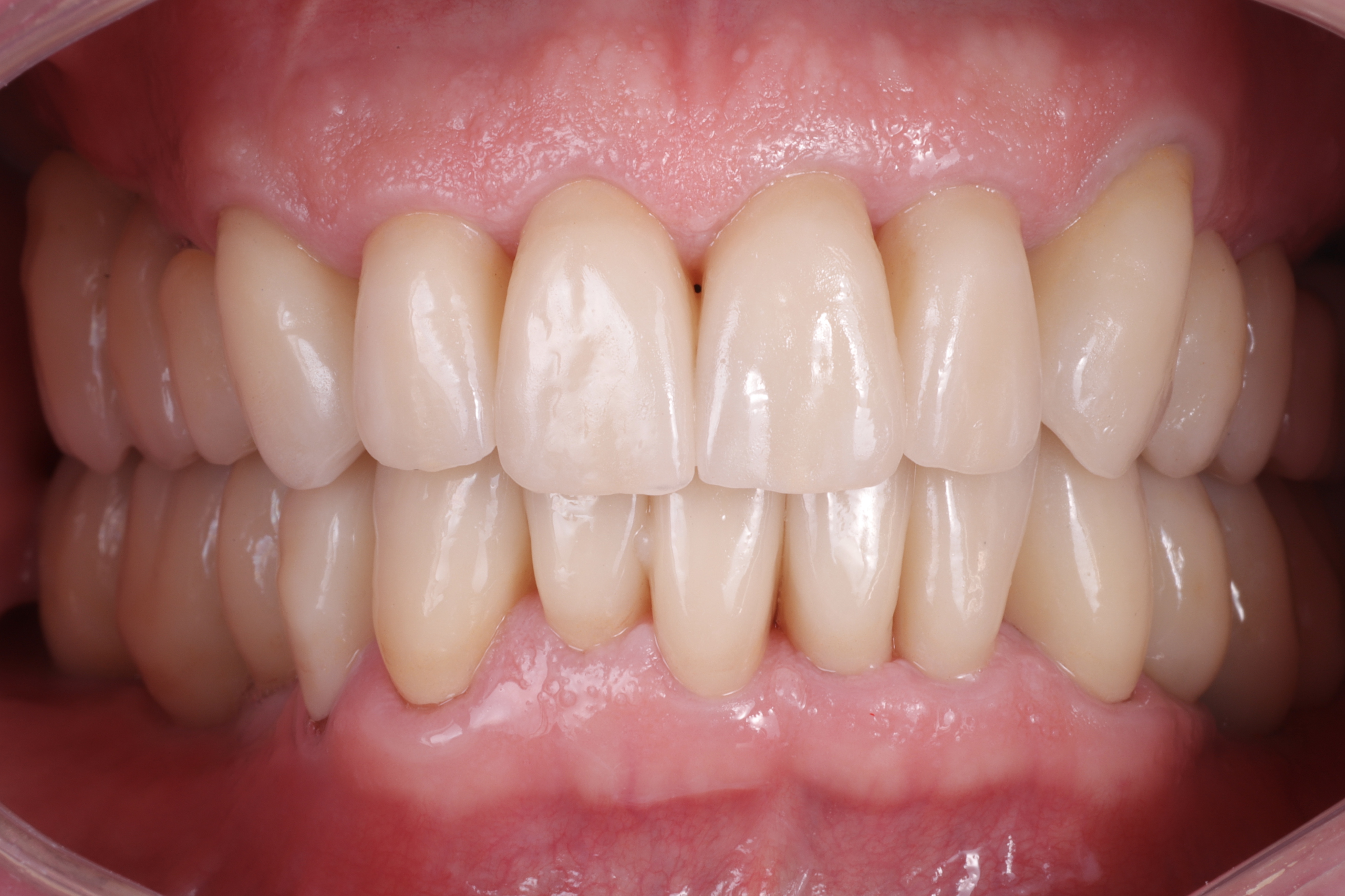 Ästhetische Zahnheilkunde